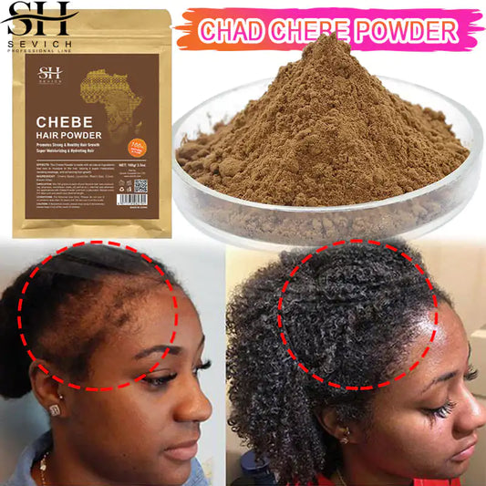 Alopecia Treatment Oil Natural Crazy Hair Regrowth